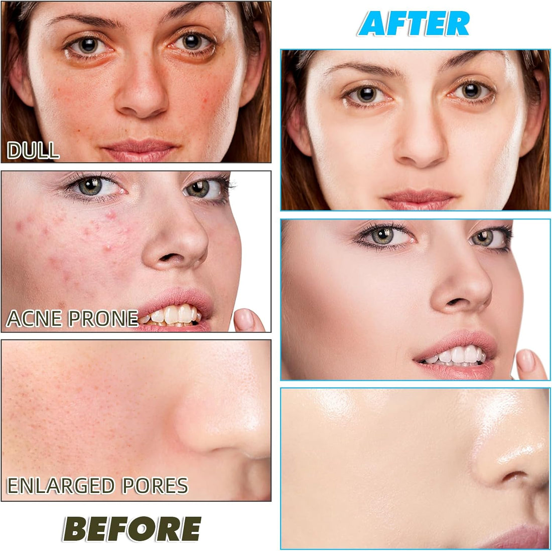 Turmeric and Kojic Acid Pads for Face